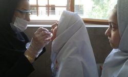 اجرای وارنیش‌ فلورایدتراپی برای بیش‌از ۱۳هزار دانش‌آموز در غرب هرمزگان