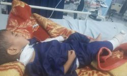 کودک مجروح شده در حمله بامدادی به بندرعباس