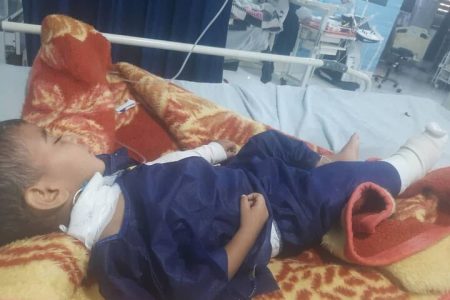 کودک مجروح شده در حمله بامدادی به بندرعباس