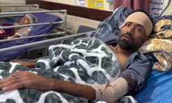 هنرمند اهل سیریک در جریان جنایت شب گذشته دشمن در سیریک مجروح شد